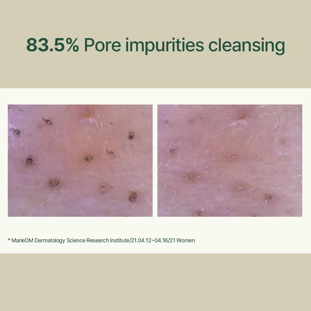 Pyunkang Yul PKY Calming Low pH Foaming Cleanser - Daily Face Wash & Makeup Remover with Tea Tree, Centella Asiatica, 5 Hyaluronic Acids, 150ml Mizon