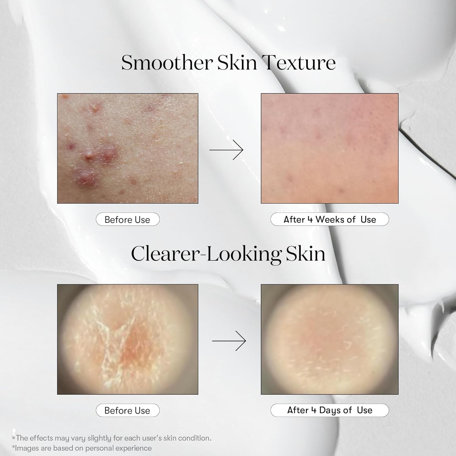 VT COSMETICS CICA Reedle Shot 300 Essence, Intensive Face Essence, Centella Complex, Hyaluronic Acid, Green Propolis Extract (30ml) VT COSMETICS