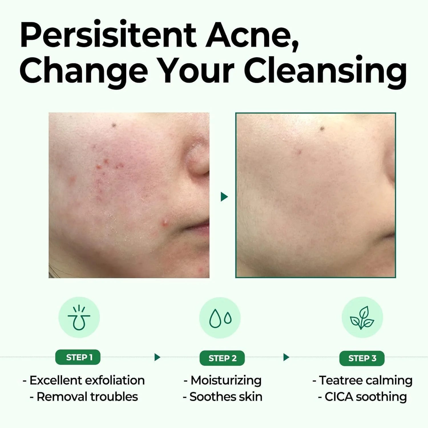 Some By Mi Aha Bha Pha 30 Days Miracle Cleansing Bar 106G