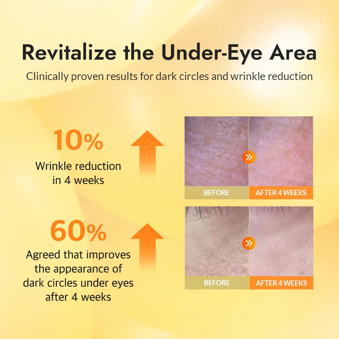 MIZON Snail Repair Intensive Gold Eye Gel Patch 30 Pairs Mizon