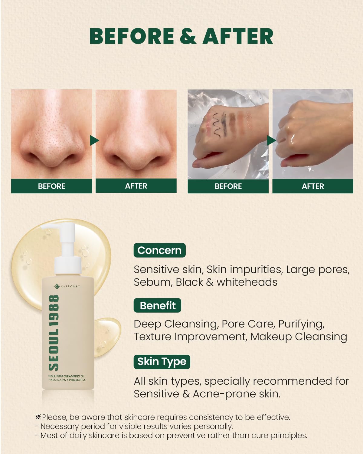 K-SECRET SEOUL 1988 Cica Cleansing Oil â€“ Deep Pore Cleansing & Gentle Exfoliation | Daily Oil Cleanser for Sensitive Skin | Korean Skincare, 200ml K-SECRET