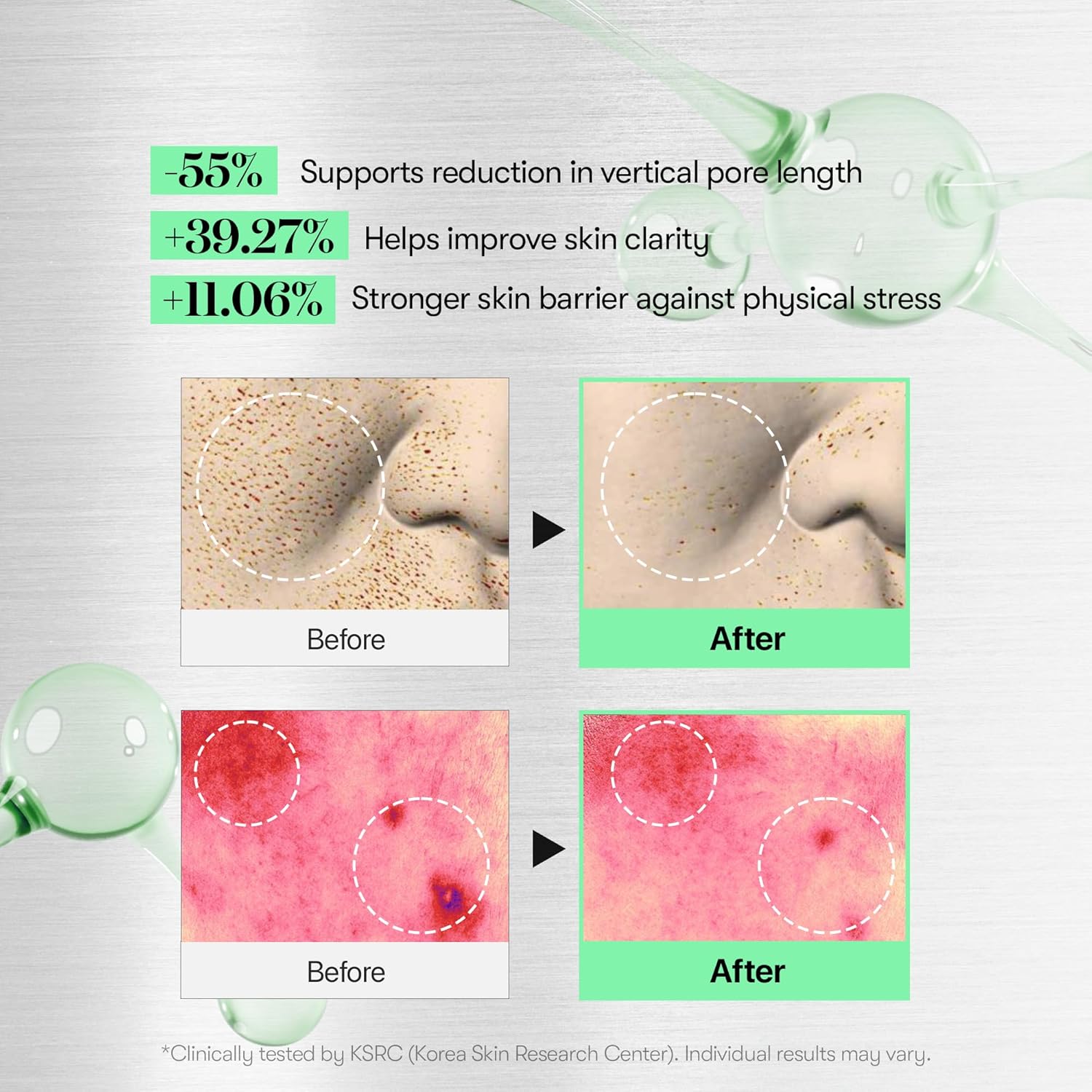 VT COSMETICS CICA Reedle Shot 100 Essence, Daily Face Essence, Centella Complex, Hyaluronic Acid, Green Propolis Extract for All Skin Types 1.69Fl Oz (50ml) Beauty Matters