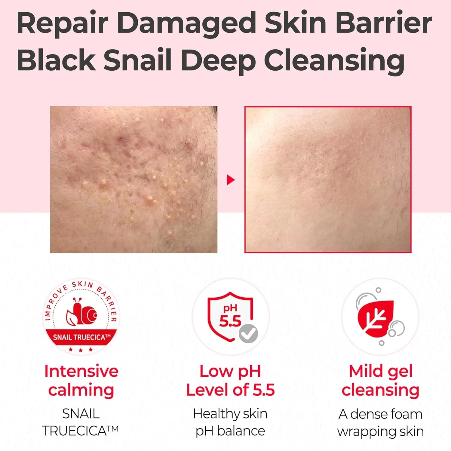 Some By Mi Snail Truecica Miracle Repair Low Ph Gel Cleanser 100Ml