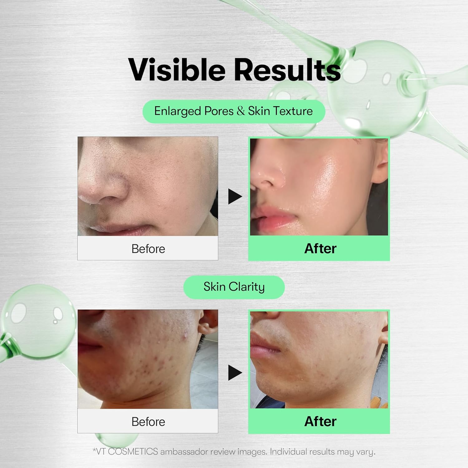 VT COSMETICS CICA Reedle Shot 100 Essence, Daily Face Essence, Centella Complex, Hyaluronic Acid, Green Propolis Extract for All Skin Types 1.69Fl Oz (50ml) Beauty Matters