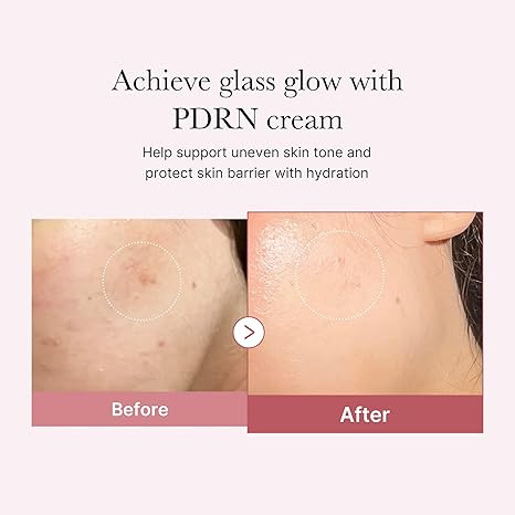 Medicube Salmon DNA PDRN Pink Hyaluronic Moisturizing Cream | Blemish Relief & Hydrating Care | Restores Skin Elasticity & Glow | Korean Skincare, Even Skin Tone & Pore Care | 50ml medicube