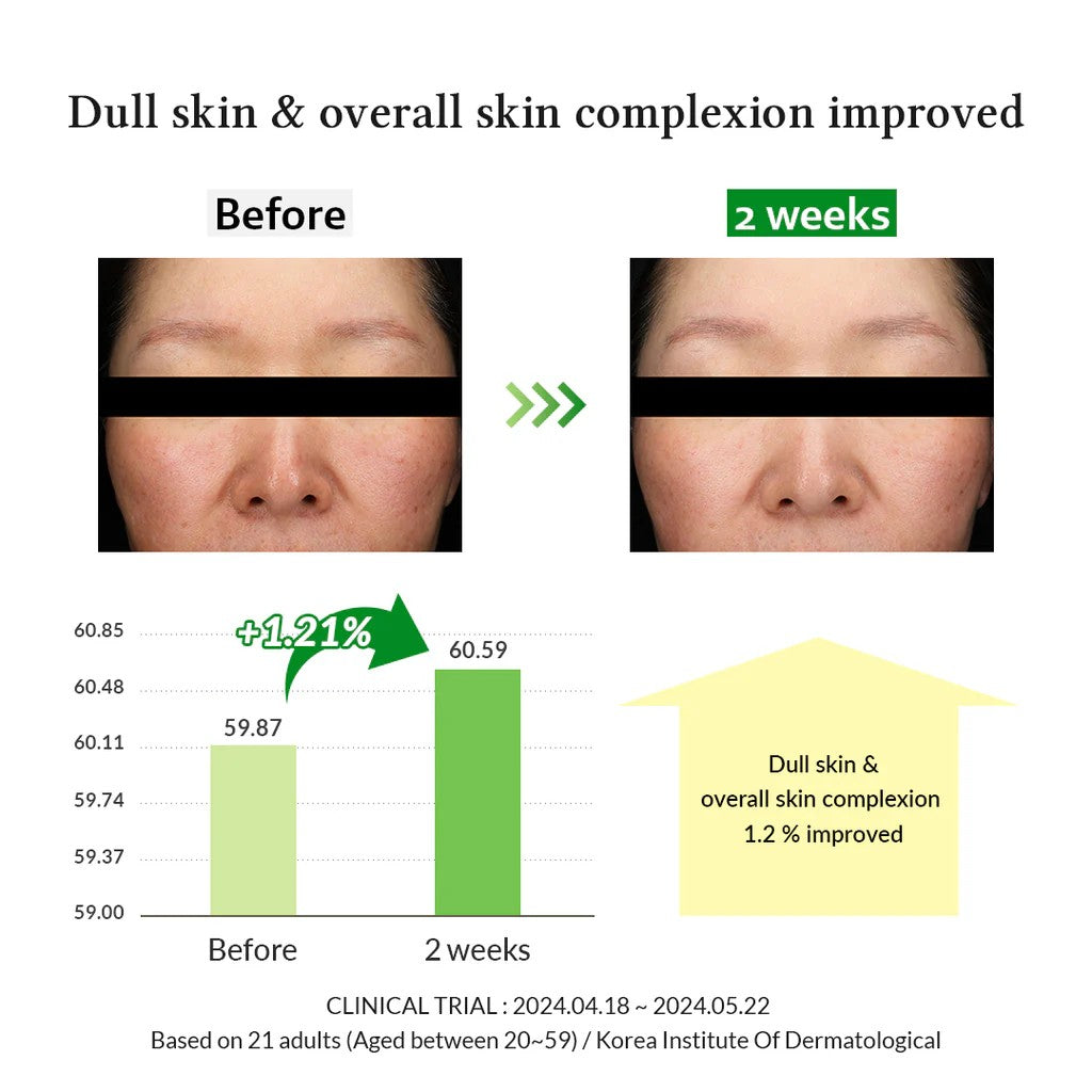 Dr.Althea Gentle Vitamin C Serum | Daily Vitamin C Serum for All Skin Types | Helps Remove Dark Spots & Uneven Skin Tone | Korean Vegan Skincare | 30ml Beauty Matters