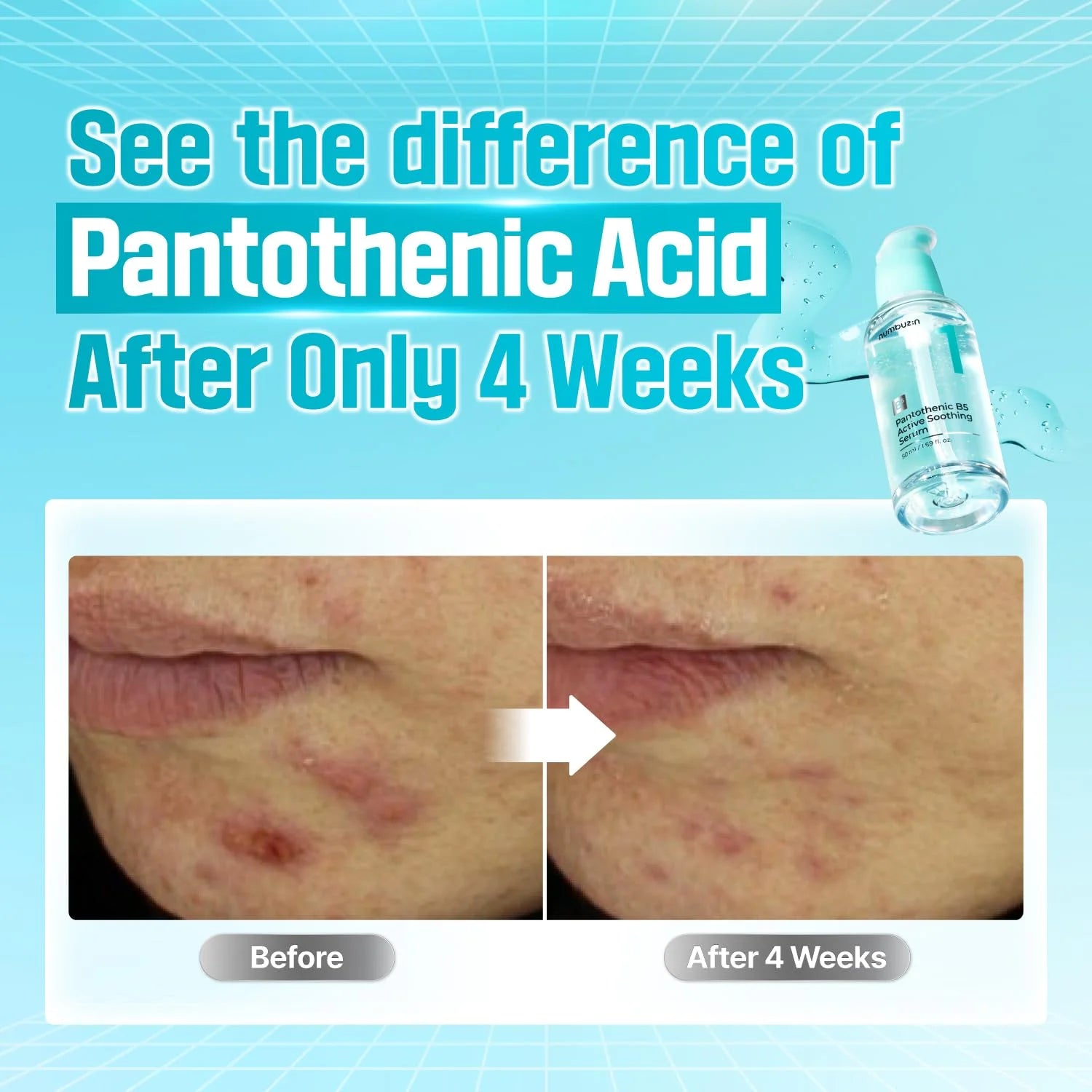 Numbuzin No.1 Pantothenic B5 Active Soothing Serum (50ml)
