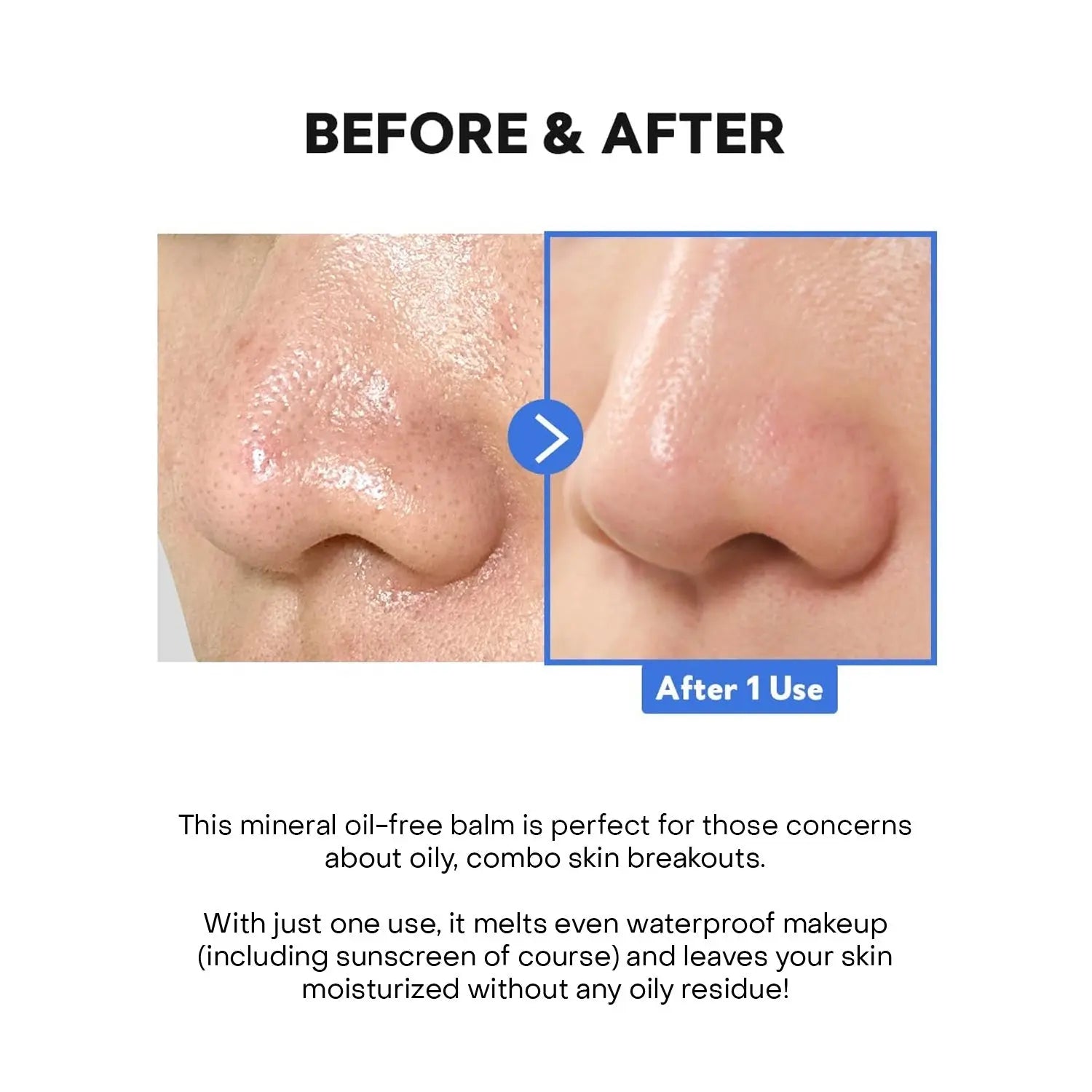 TirTir Hydro Boost Enzyme Cleansing Balm TirTir