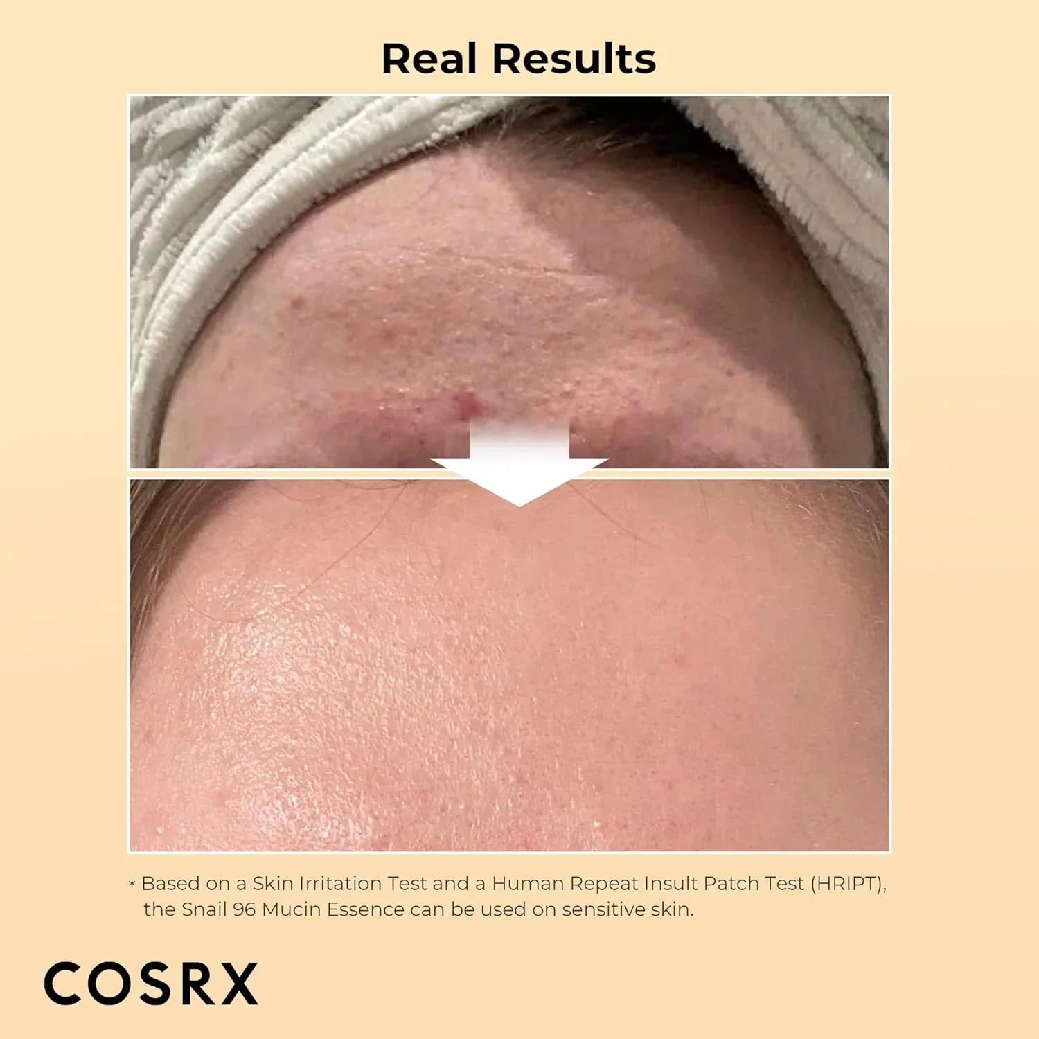 Cosrx Advanced Snail 96 Mucin Power Essence (100Ml) Cosrx